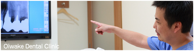 インプラント治療